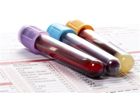 coagulation blood test bottle|blood bottle toxicology test.